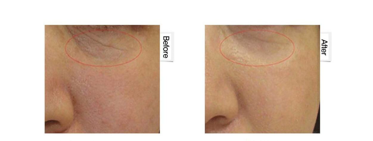 目元の症例写真