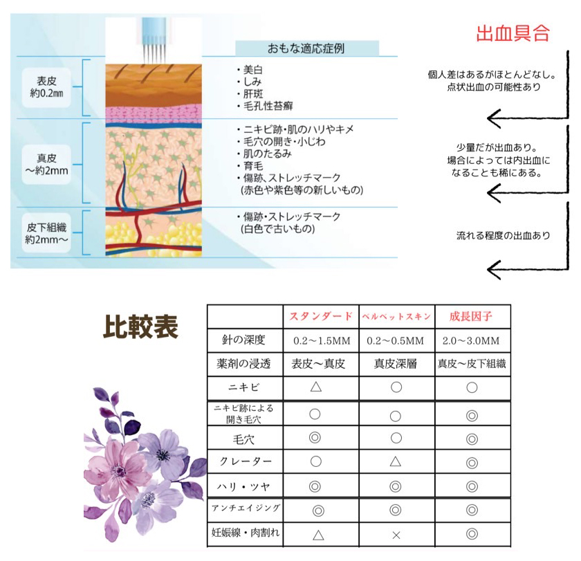 目的別ハリの深さと料金表