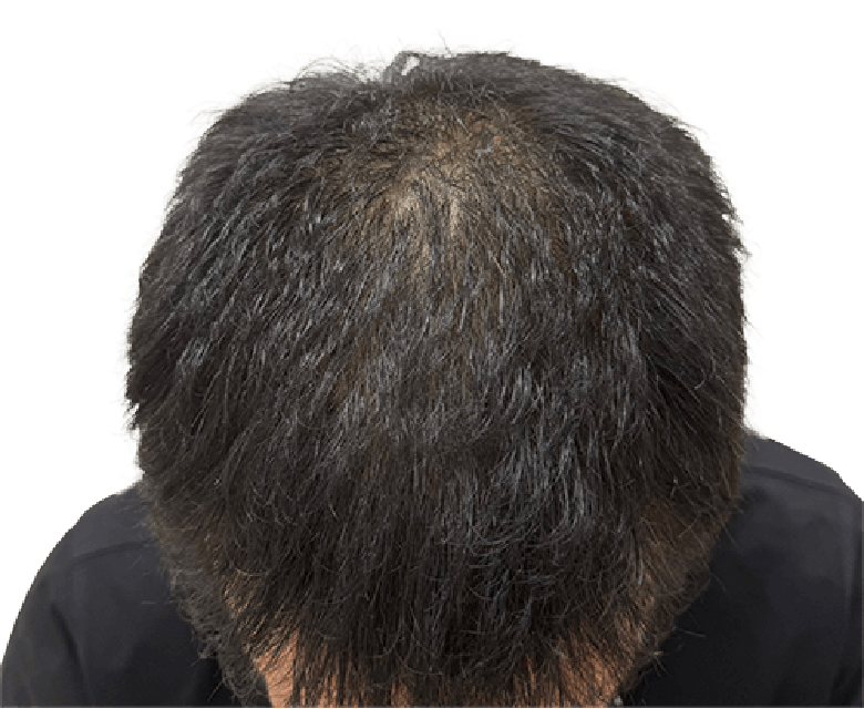 写真：施術直後