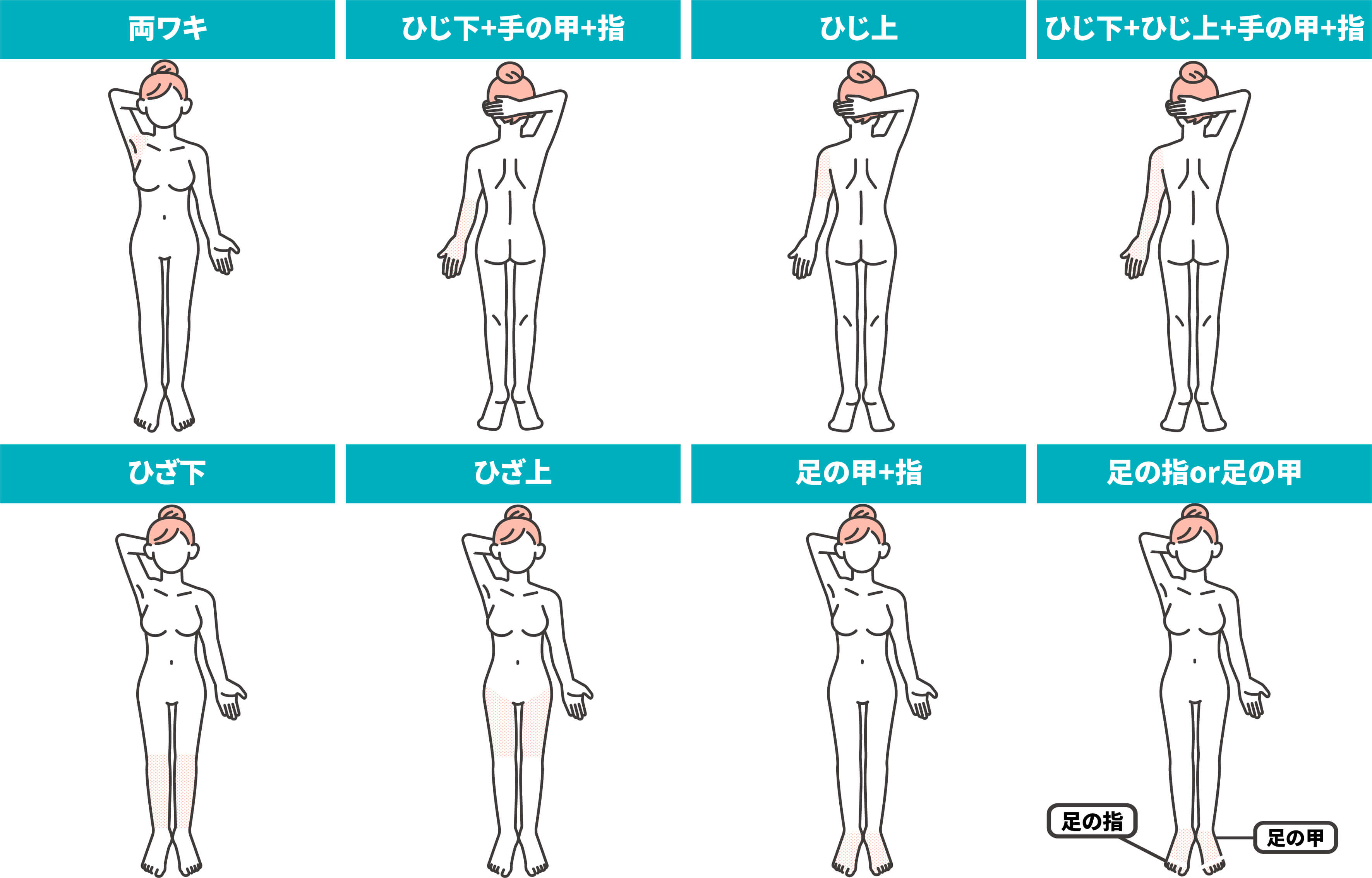 脱毛箇所
