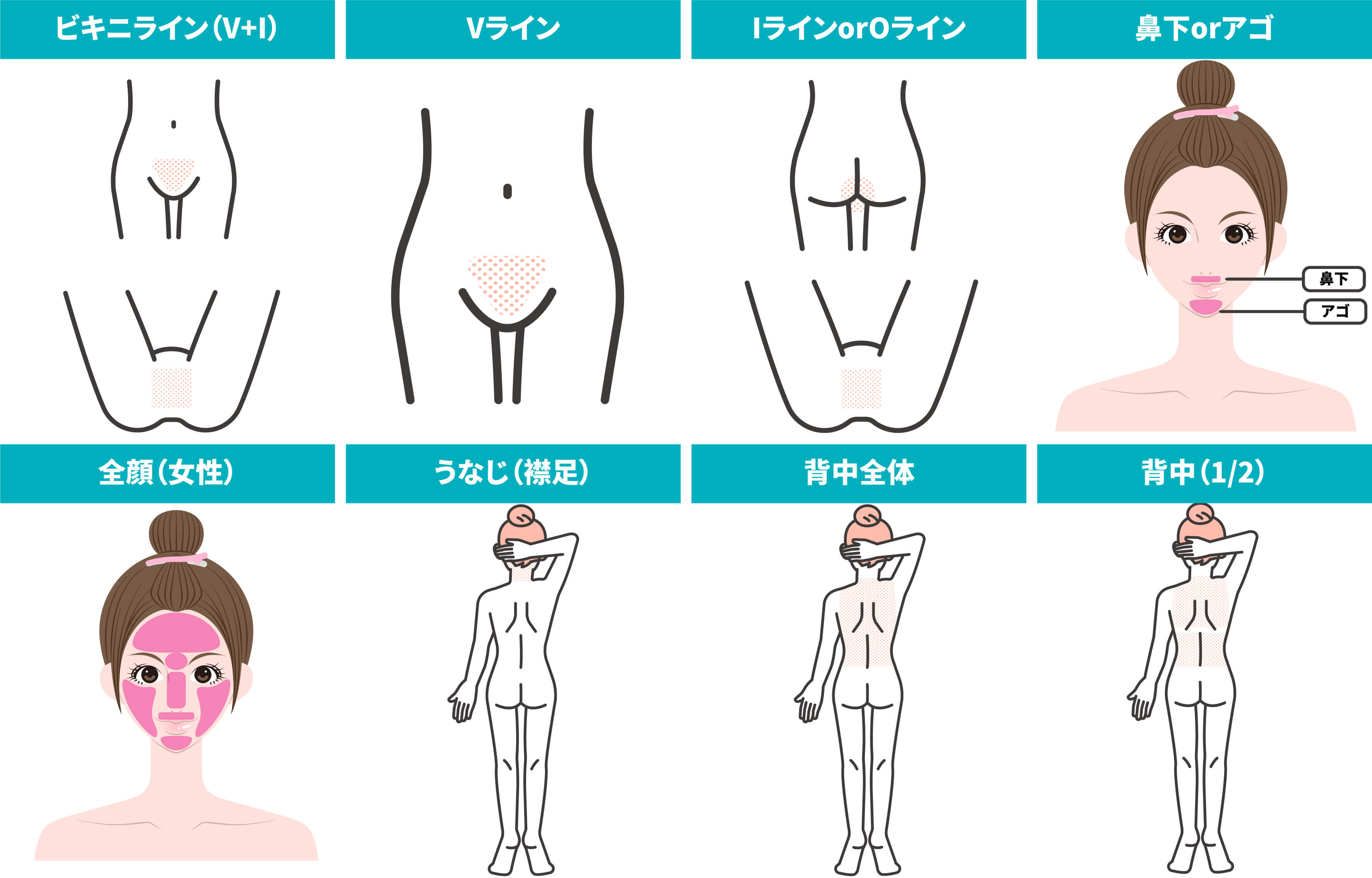 脱毛箇所